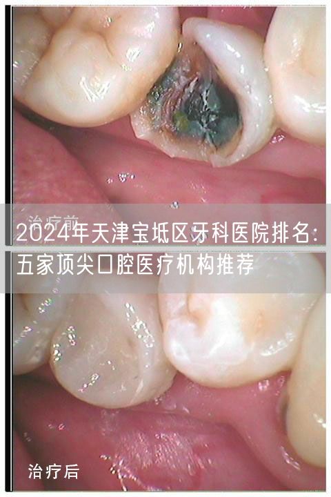 2024年天津宝坻区牙科医院排名：五家顶尖口腔医疗机构推荐