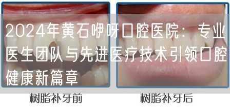 2024年黄石咿呀口腔医院：专业医生团队与先进医疗技术引领口腔健康新篇章