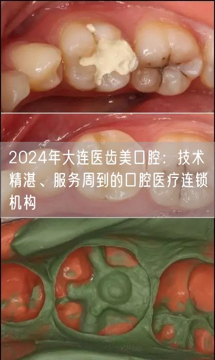 2024年大连医齿美口腔：技术精湛、服务周到的口腔医疗连锁机构