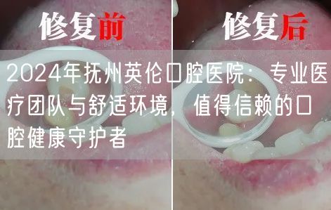 2024年抚州英伦口腔医院：专业医疗团队与舒适环境，值得信赖的口腔健康守护者