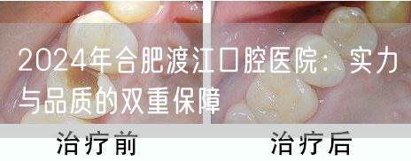 2024年合肥渡江口腔医院：实力与品质的双重保障
