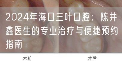 2024年海口三叶口腔：陈井鑫医生的专业治疗与便捷预约指南