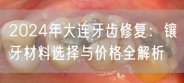 2024年大连牙齿修复：镶牙材料选择与价格全解析