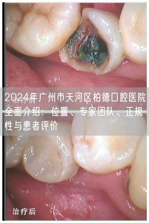 2024年广州市天河区柏德口腔医院全面介绍：位置、专家团队、正规性与患者评价