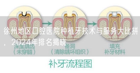 徐州地区口腔医院种植牙技术与服务大比拼，2024年排名揭晓