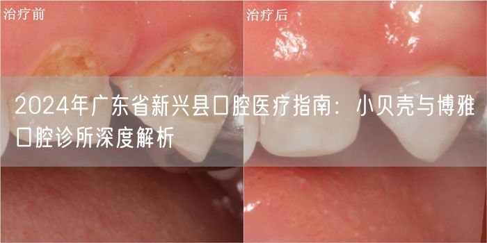 2024年广东省新兴县口腔医疗指南：小贝壳与博雅口腔诊所深度解析