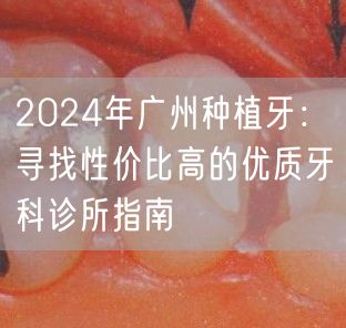 2024年广州种植牙：寻找性价比高的优质牙科诊所指南