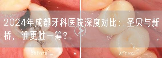2024年成都牙科医院深度对比：圣贝与新桥，谁更胜一筹？