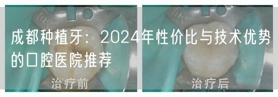 成都种植牙：2024年性价比与技术优势的口腔医院推荐