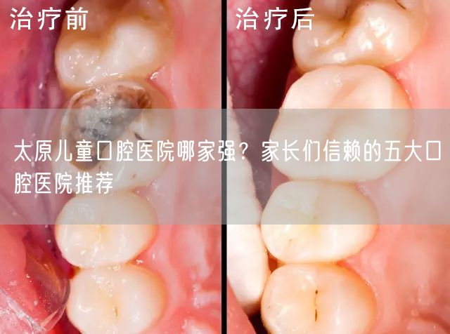 太原儿童口腔医院哪家强？家长们信赖的五大口腔医院推荐