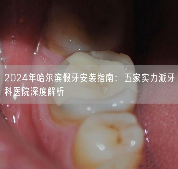 2024年哈尔滨假牙安装指南：五家实力派牙科医院深度解析