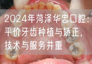 2024年菏泽华忠口腔：平价牙齿种植与矫正，技术与
