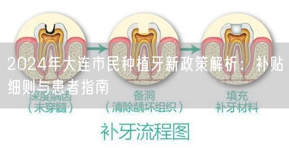 2024年大连市民种植牙新政策解析：补贴细则与患者指南