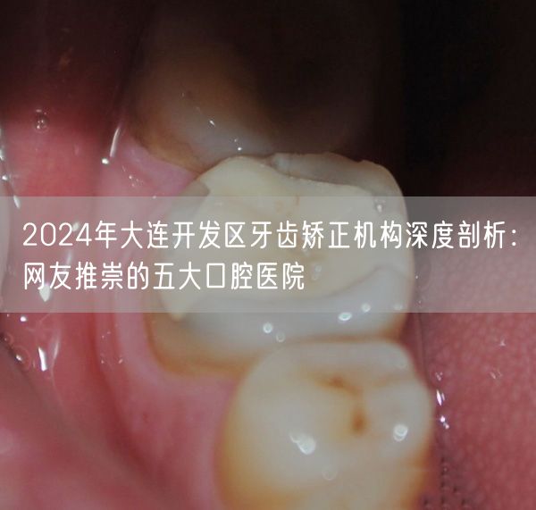 2024年大连开发区牙齿矫正机构深度剖析：网友推崇的五大口腔医院
