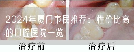 2024年厦门市民推荐：性价比高的口腔医院一览