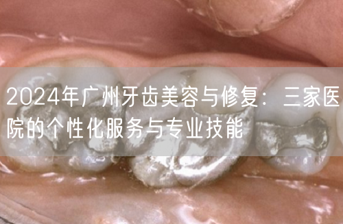 2024年广州牙齿美容与修复：三家医院的个性化服务与专业技能