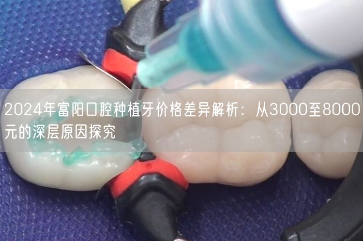 2024年富阳口腔种植牙价格差异解析：从3000至8000元的深层原因探究
