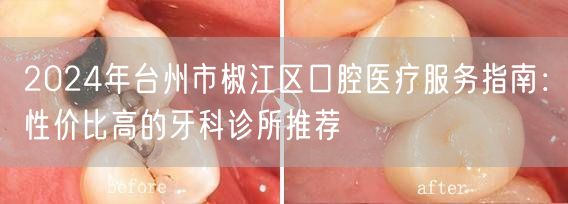 2024年台州市椒江区口腔医疗服务指南：性价比高的牙科诊所推荐