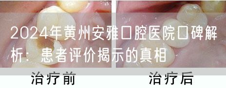 2024年黄州安雅口腔医院口碑解析：患者评价揭示的真相