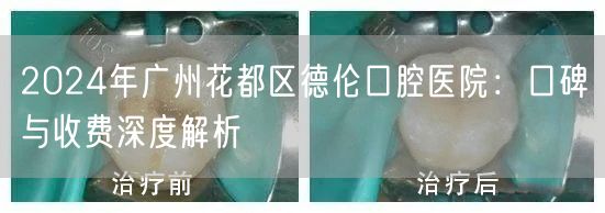 2024年广州花都区德伦口腔医院：口碑与收费深度解析