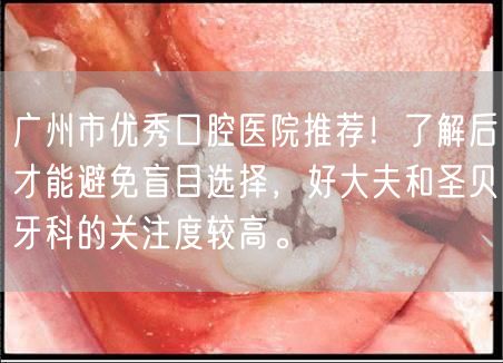 广州市优秀口腔医院推荐！了解后才能避免盲目选择，好大夫和圣贝牙科的关注度较高。
