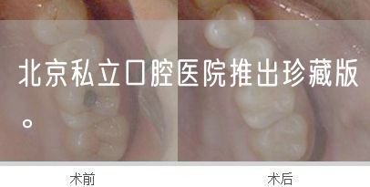 北京私立口腔医院推出珍藏版。