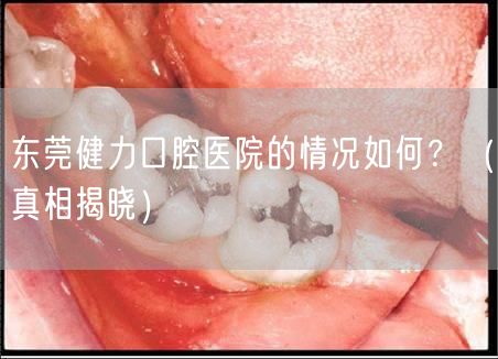 东莞健力口腔医院的情况如何？（真相揭晓）
