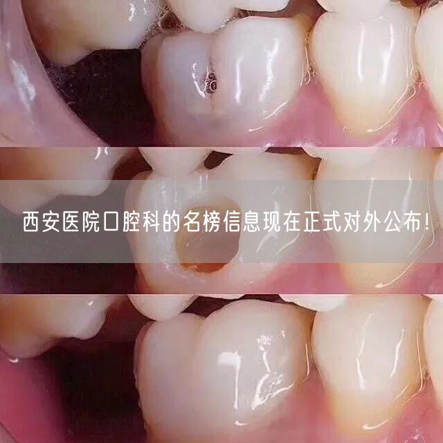 西安医院口腔科的名榜信息现在正式对外公布！