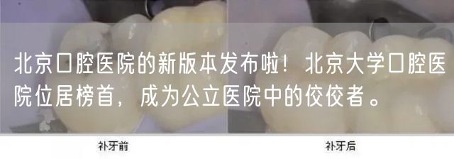 北京口腔医院的新版本发布啦！北京大学口腔医院位居榜首，成为公立医院中的佼佼者。