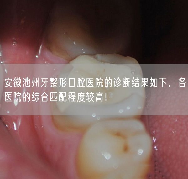 安徽池州牙整形口腔医院的诊断结果如下，各医院的综合匹配程度较高！