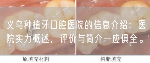 义乌种植牙口腔医院的信息介绍：医院实力概述，评价与简介一应俱全。