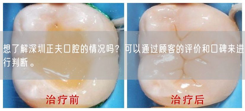 想了解深圳正夫口腔的情况吗？可以通过顾客的评价和口碑来进行判断。
