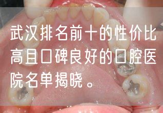 武汉排名前十的性价比高且口碑良好的口腔医院名单揭晓。