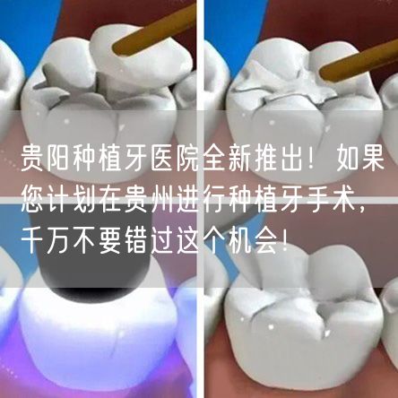 贵阳种植牙医院全新推出！如果您计划在贵州进行种植牙手术，千万不要错过这个机会！
