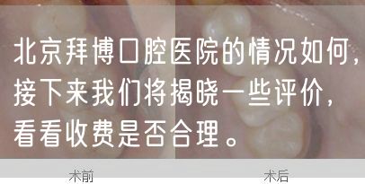 北京拜博口腔医院的情况如何，接下来我们将揭晓一些评价，看看收费是否合理。