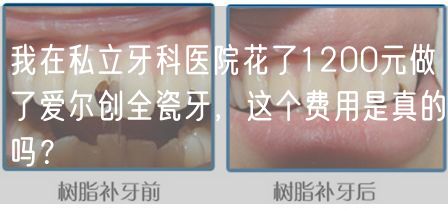 我在私立牙科医院花了1200元做了爱尔创全瓷牙，这个费用是真的吗？