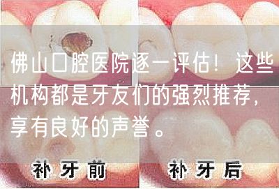 佛山口腔医院逐一评估！这些机构都是牙友们的强烈推荐，享有良好的声誉。