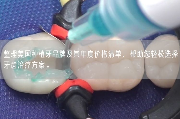 整理美国种植牙品牌及其年度价格清单，帮助您轻松选择牙齿治疗方案。