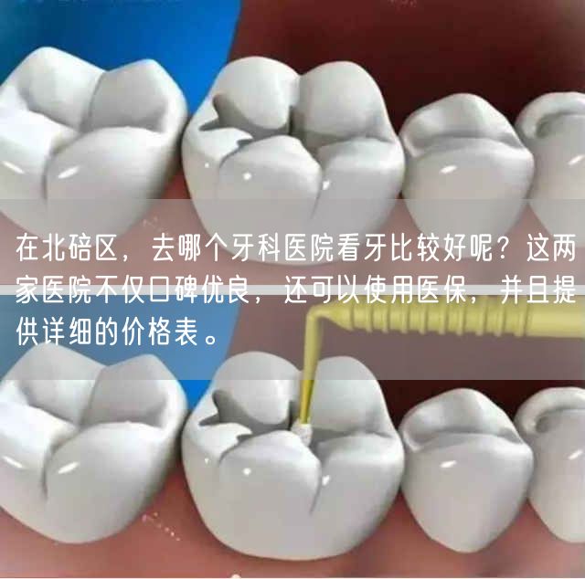 在北碚区，去哪个牙科医院看牙比较好呢？这两家医院不
