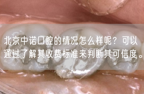 北京中诺口腔的情况怎么样呢？可以通过了解其收费标准来判断其可信度。