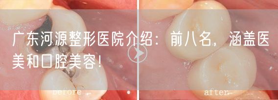 广东河源整形医院介绍：前八名，涵盖医美和口腔美容！