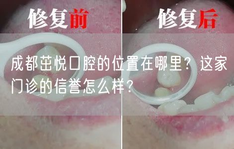 成都茁悦口腔的位置在哪里？这家门诊的信誉怎么样？