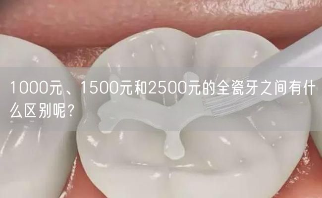 1000元、1500元和2500元的全瓷牙之间有什么区别呢？