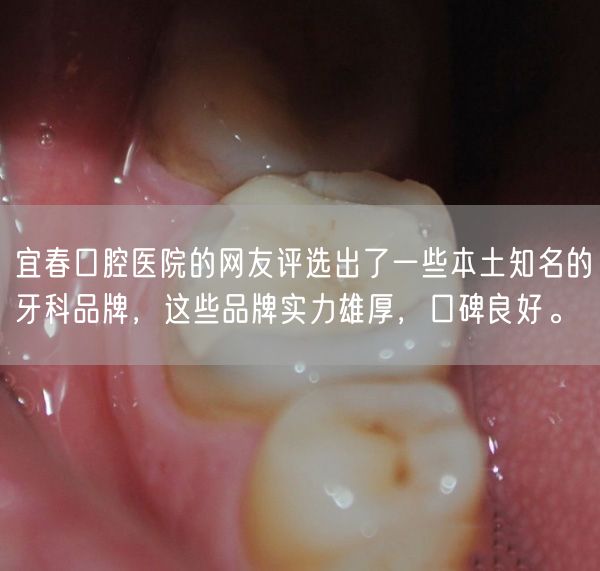 宜春口腔医院的网友评选出了一些本土知名的牙科品牌，这些品牌实力雄厚，口碑良好。