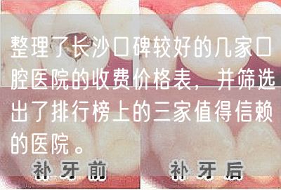 整理了长沙口碑较好的几家口腔医院的收费价格表，并筛选出了排行榜上的三家值得信赖的医院。