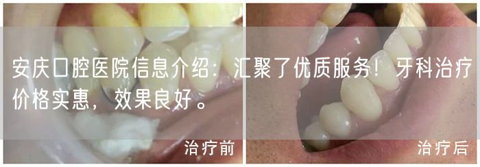安庆口腔医院信息介绍：汇聚了优质服务！牙科治疗价格实惠，效果良好。
