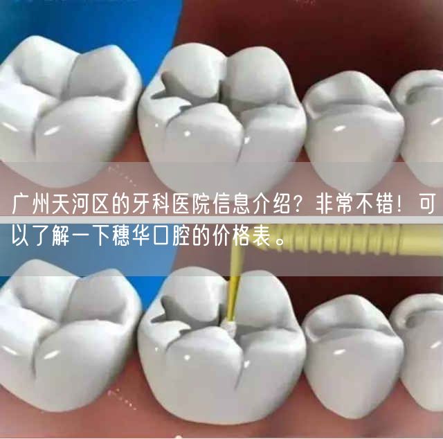 广州天河区的牙科医院信息介绍？非常不错！可以了解一下穗华口腔的价格表。