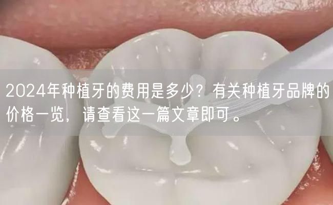 2024年种植牙的费用是多少？有关种植牙品牌的价格一览，请查看这一篇文章即可。