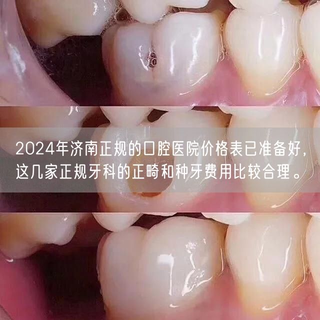 2024年济南正规的口腔医院价格表已准备好，这几家正规牙科的正畸和种牙费用比较合理。