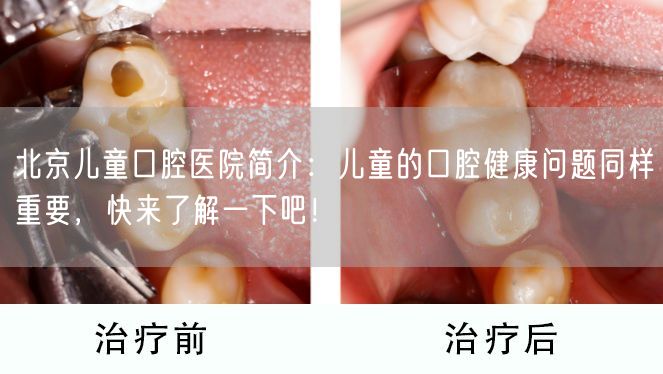 北京儿童口腔医院简介：儿童的口腔健康问题同样重要，快来了解一下吧！